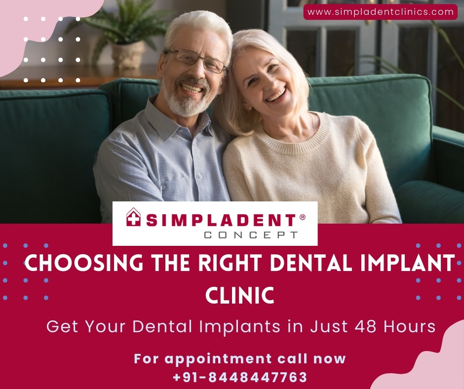 The Future of Dental Implants: Simpladent’s Immediate Loading Revolution